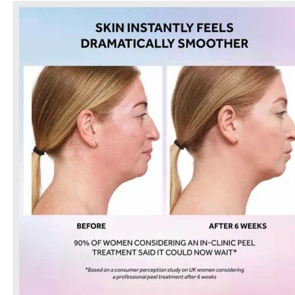 No7 Laboratories Resurfacing Peel 15% Glycolic Acid - 1 fl oz - Picture 7 of 7